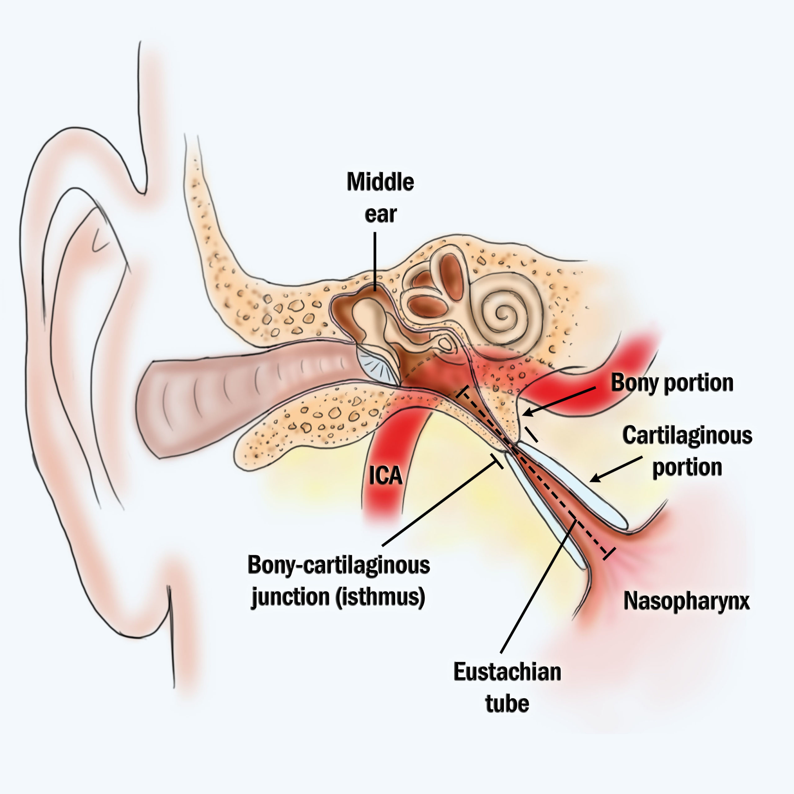 eustachian-tube-dysfunction-nicole-klein-md